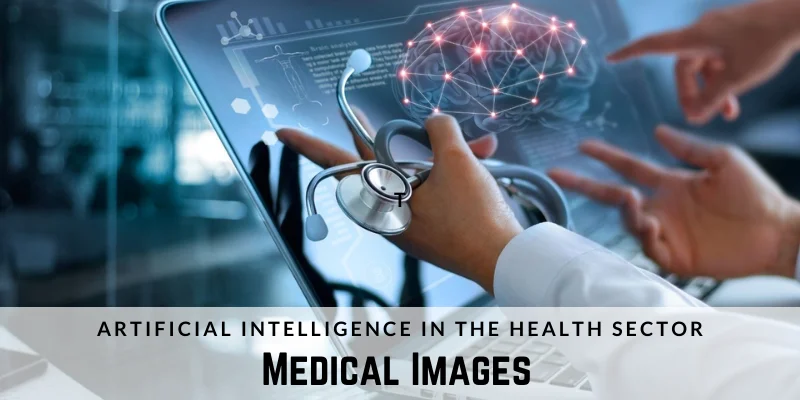 Medical Images by Artificial Intelligence